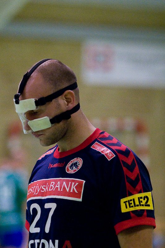 Heino Holm Knudsen med maske for at beskytte en brkket nse.